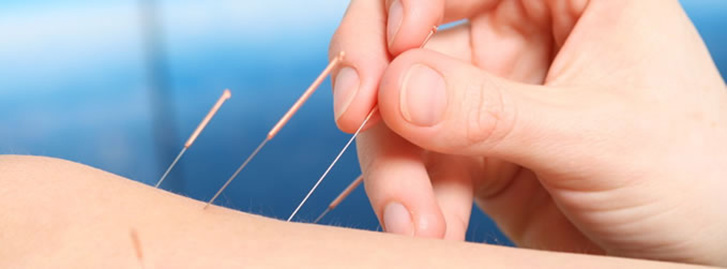 Therapie Akupunktur Therapie Akupunktur